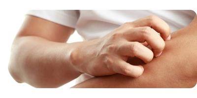 image The Best Pharmacy Products For Eczema And Dry Skin